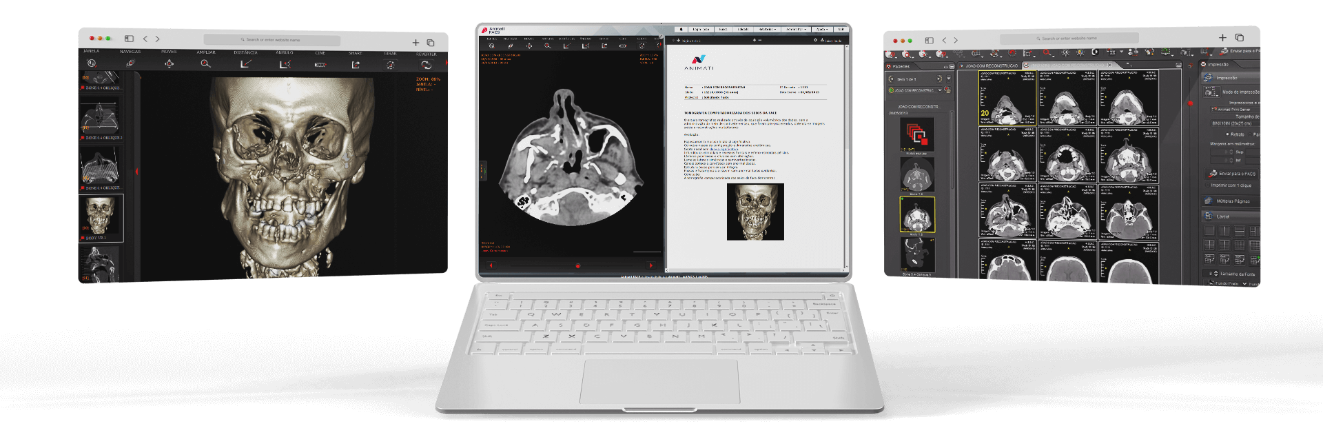 Software de Radiologia Animati netPACS