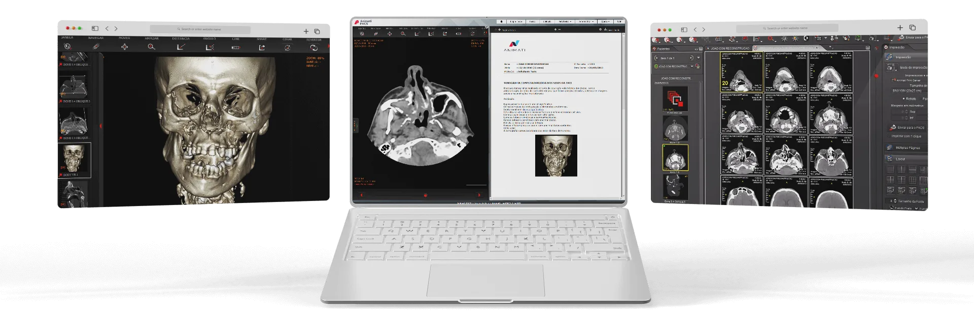 Software de Radiologia Animati netPACS