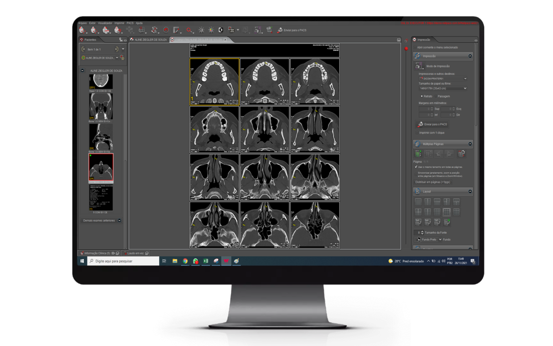 A impressão sob demanda