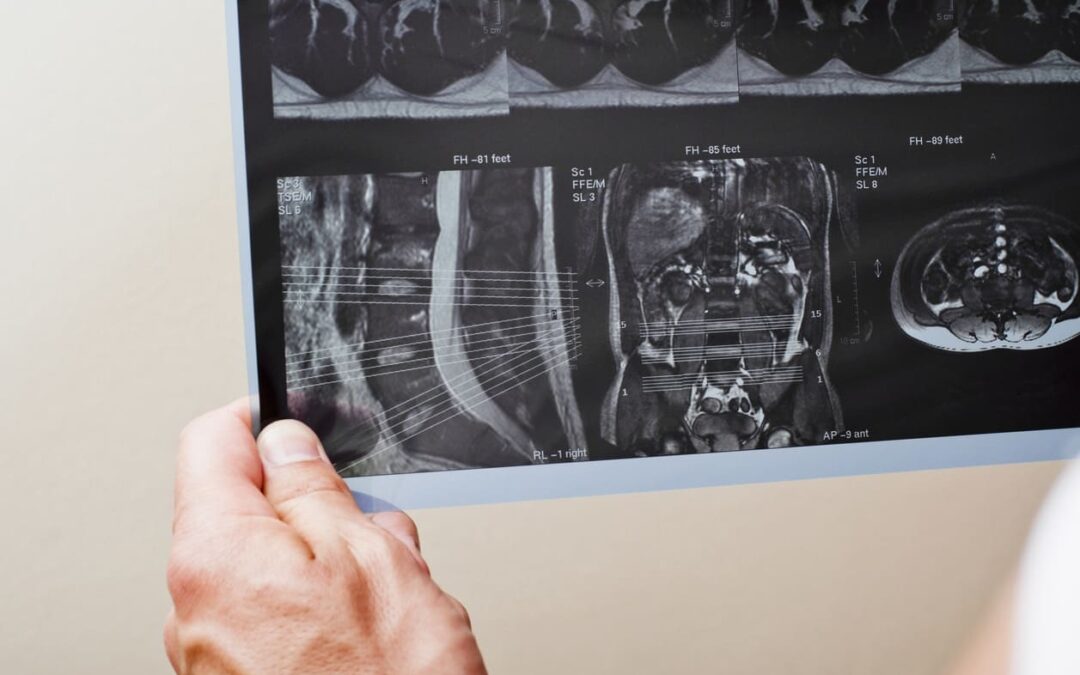 Imagem radiológica: fatores que influenciam e importância da qualidade