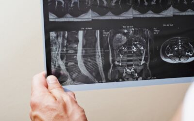 Imagem radiológica: fatores que influenciam e importância da qualidade