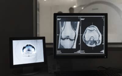 Impressões 3D na radiologia: principais aplicações e benefícios clínicos