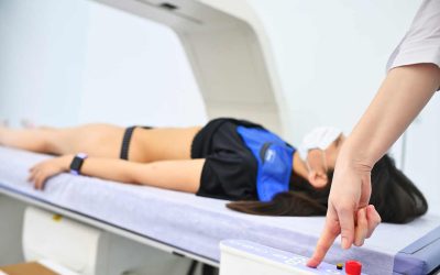 Aprenda a escolher um aparelho de densitometria óssea para sua clínica de imagem
