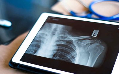 Radiografia digital: princípios e principais aplicações da tecnologia