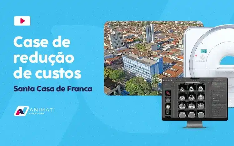 Case de sucesso dos softwares para radiologia Animati Case de sucesso dos softwares para radiologia Animati na Santa Casa de Franca