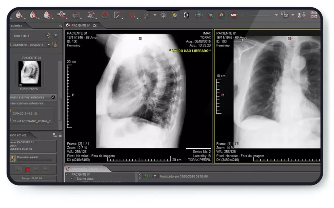 O que é uma workstation em radiologia?