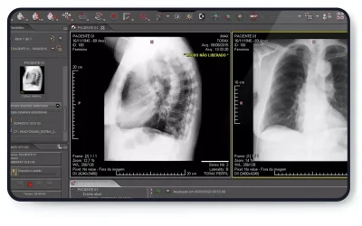 O que é uma workstation em radiologia?