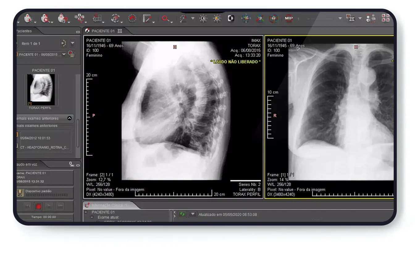 O que é uma workstation em radiologia
