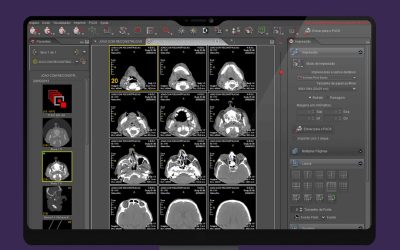 Workstation diagnóstica: Quando o visualizador vira ferramenta clínica de precisão