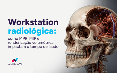 Workstation radiológica: como MPR, MIP e renderização volumétrica impactam o tempo de laudo