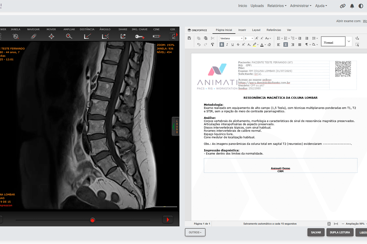 Interface do Animati Copilot com seleção de imagens e sugestão de impressão diagnóstica para radiologista