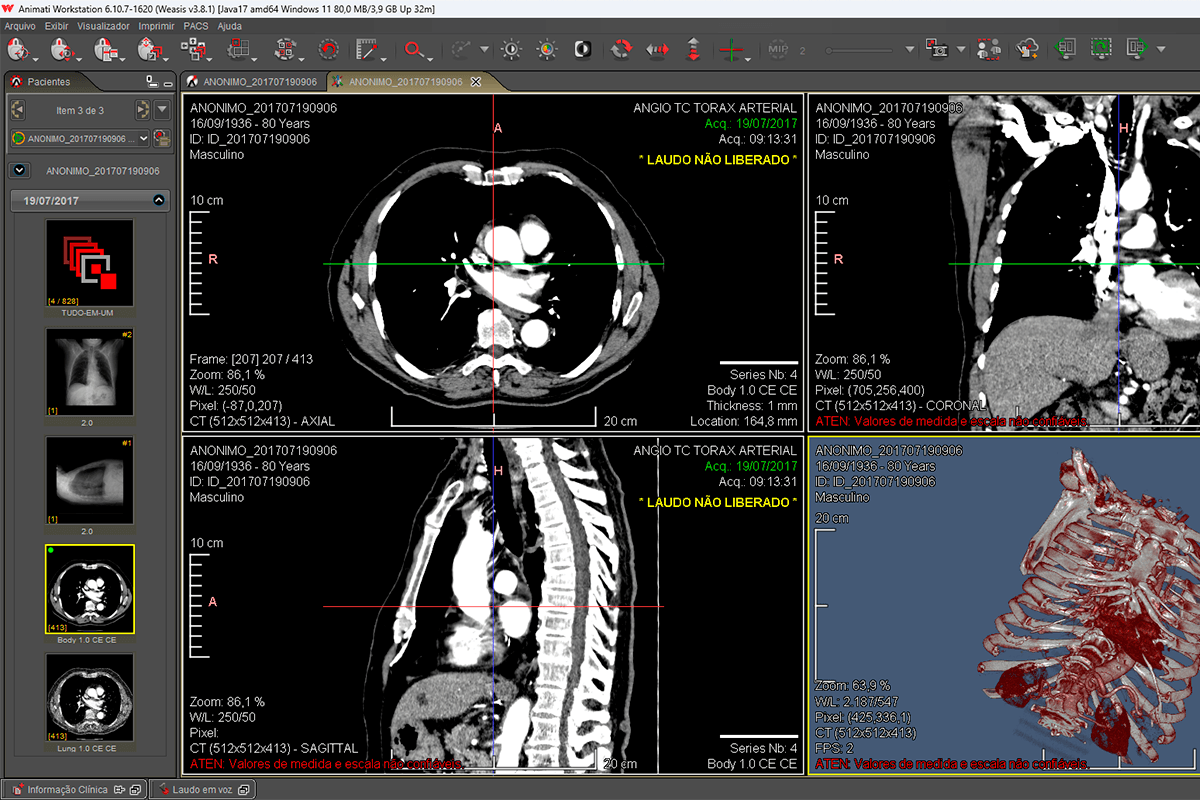 Tela do Animati Workstation com imagens do exame e dados clínicos integrados do Animati RIS, mostrando integração PACS e RIS para radiologista